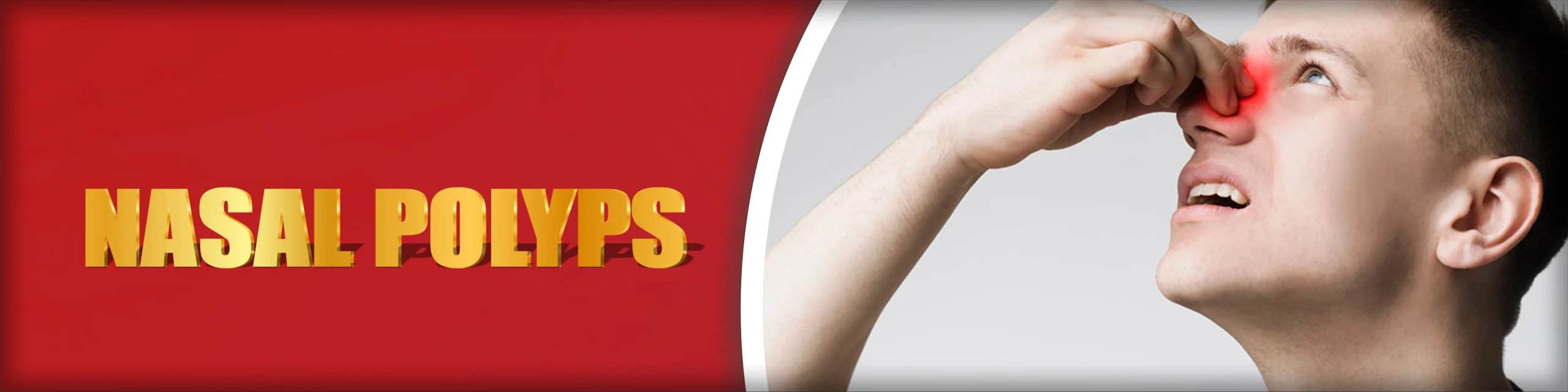 Nasal Polyps