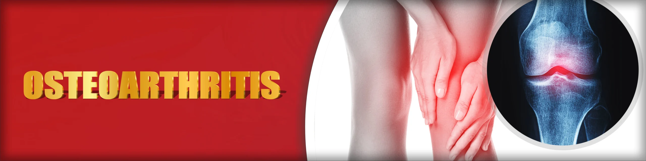 Osteoarthritis