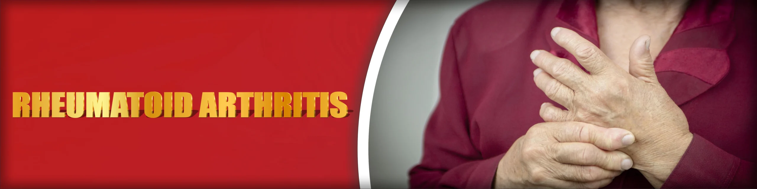 Rheumatoid Arthritis