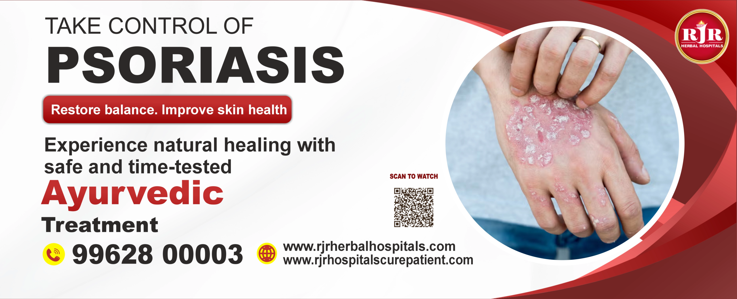 Take Control of Psoriasis Naturally