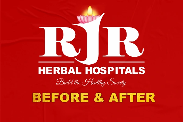 Before after patients results Siddha Ayurveda treatment healing transformation India