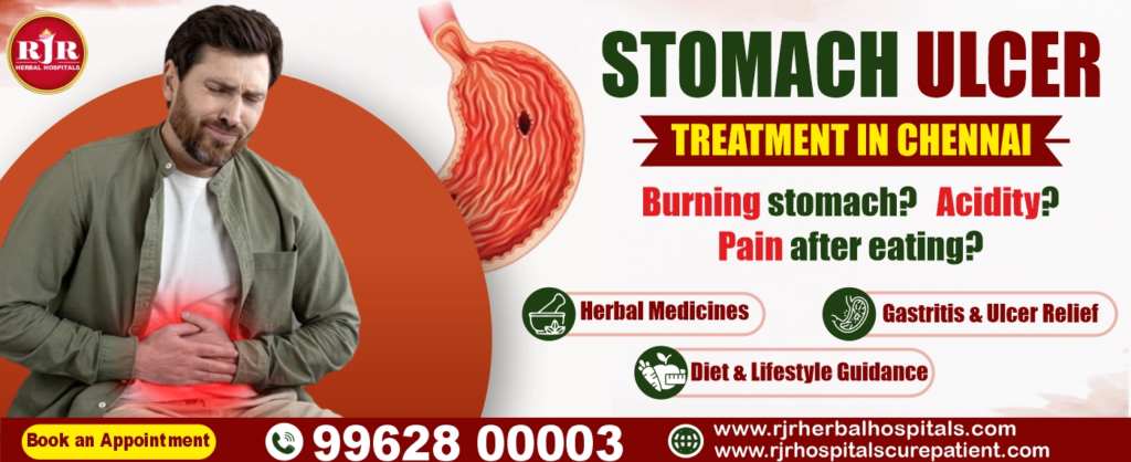 Stomach Ulcer Treatment in Chennai – Natural Siddha & Ayurveda Care
