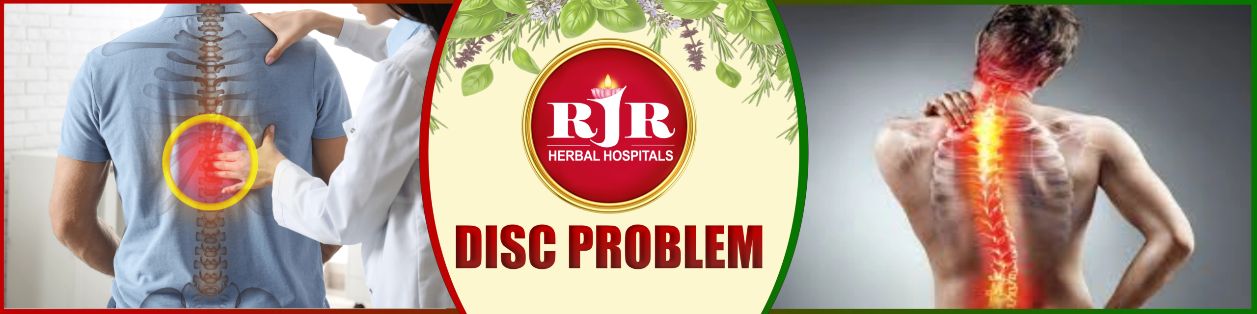 Disc Problem