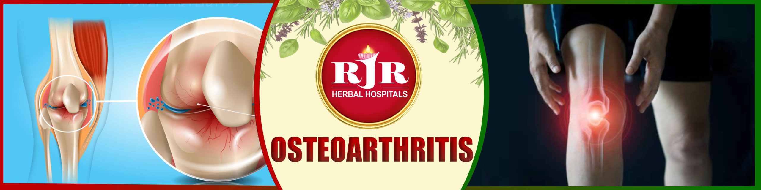 Osteoarthritis – Tamil