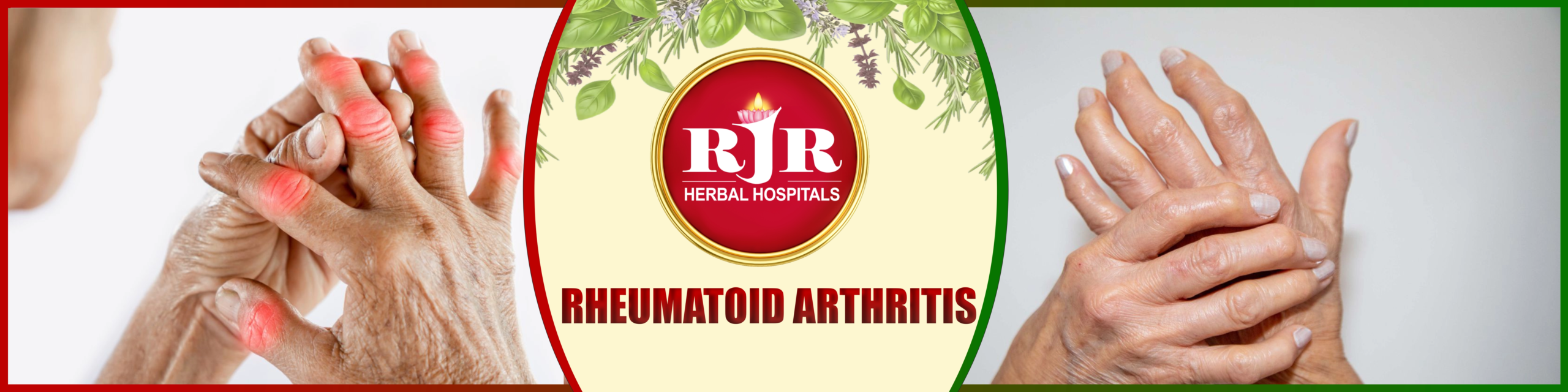 Rheumatoid Arthritis – Telugu