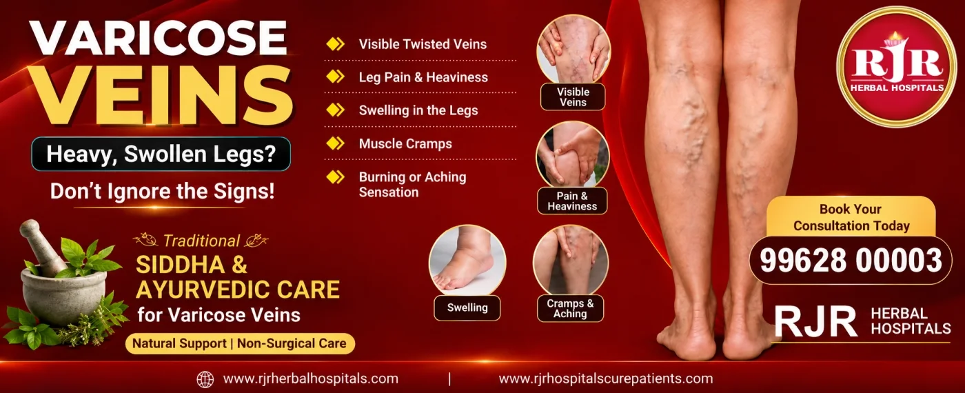 Varicose Veins Treatment Without Surgery: Symptoms, Causes & Natural Relief